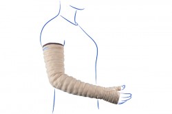 Lymphedema